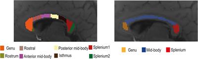 Influence of 7T GRE-MRI Signal Compartment Model Choice on Tissue Parameters